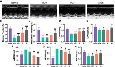 Apocynum venetum leaf extract alleviated doxorubicin-induced cardiotoxicity by regulating organic acid metabolism in gut microbiota